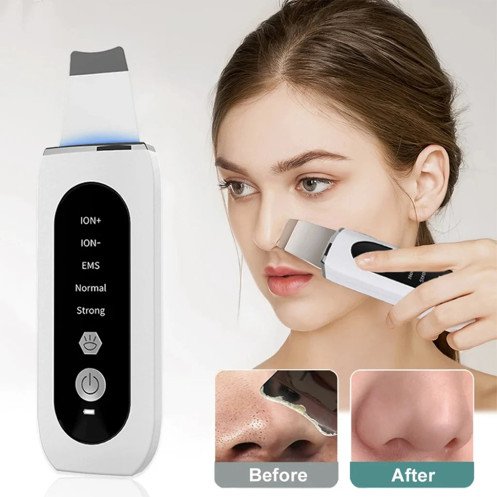 Ultrasonic Skin Scrubber – Deep Pore Cleansing & Blackhead Removal