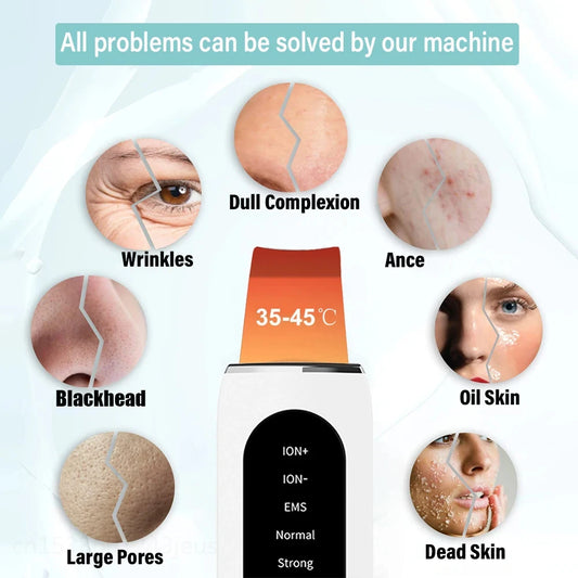 Ultrasonic Skin Scrubber – Deep Pore Cleansing & Blackhead Removal