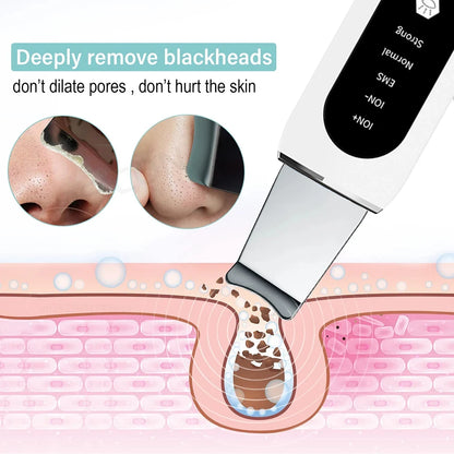 Ultrasonic Skin Scrubber – Deep Pore Cleansing & Blackhead Removal