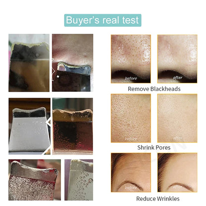 Ultrasonic Skin Scrubber – Deep Pore Cleansing & Blackhead Removal